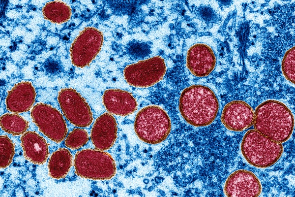 Monkeypox viewed under microscope