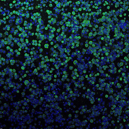 Insect cells. The image appears as blue and green dots