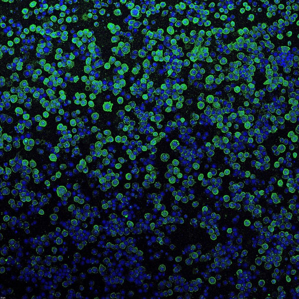 Insect cells. The image appears as blue and green dots