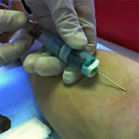 Could a Blood Test Reveal If You Have Early-Stage Cancer?