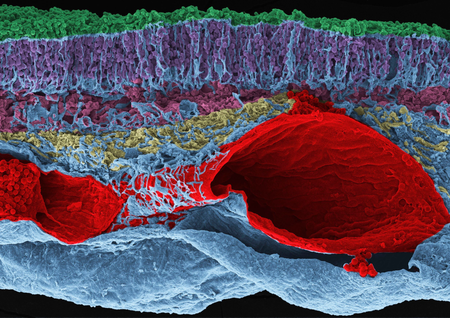 Whale Retina Rainbow