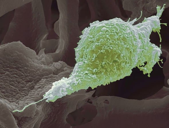 Cancer Cells Can't Proliferate and Invade at the Same Time