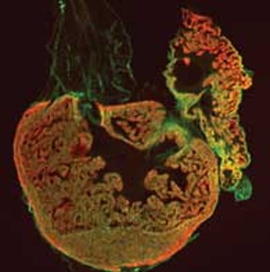 Zebrafish Mend Broken Hearts