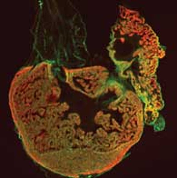 Zebrafish Mend Broken Hearts