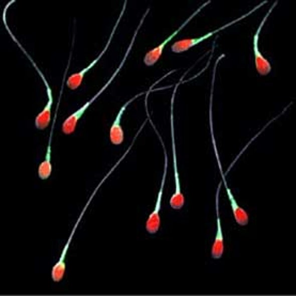 Everyday BPA Exposure Decreases Human Semen Quality