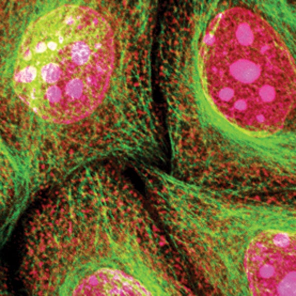 A View to a Kill: New Imaging Watches How Mitochondria Change During Disease
