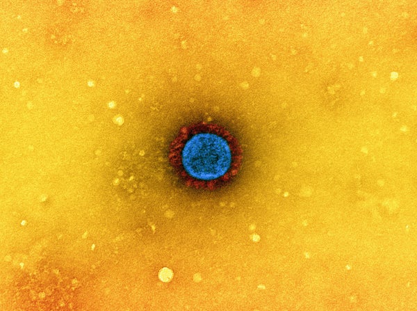SARS-CoV-2 virus particle detail
