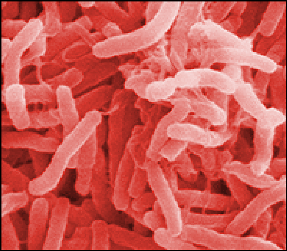 More Sensitive, Quicker Test Developed for Cholera and Botulism ...