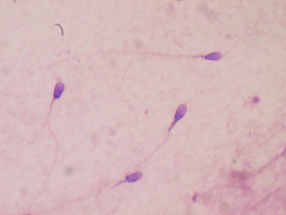 New Sperm Tests May Offer Better Understanding of Male Infertility