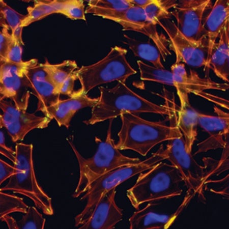 stem cell