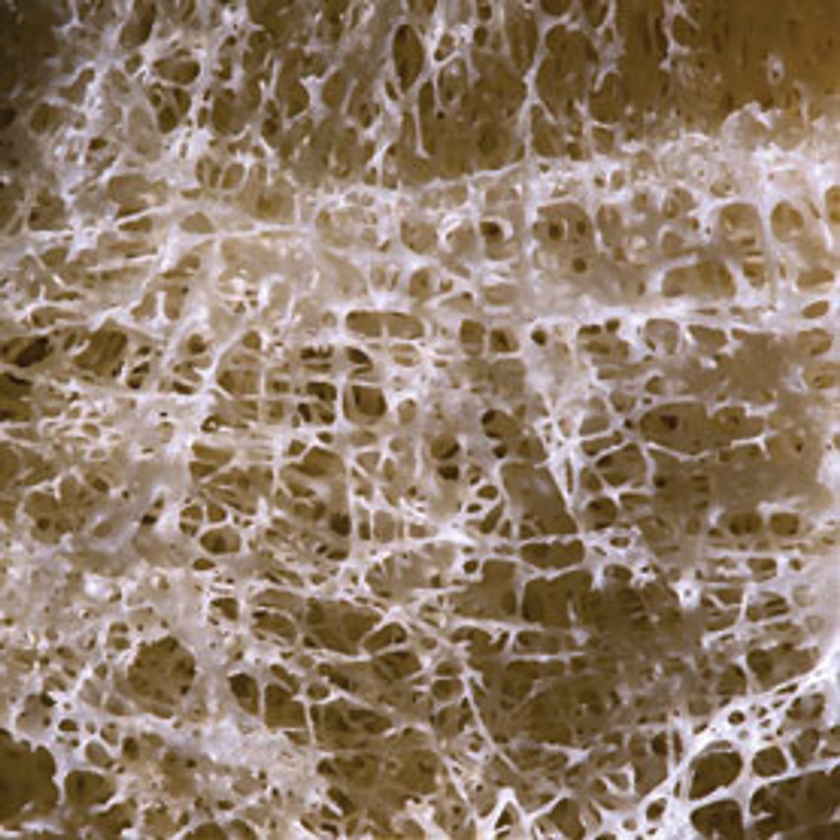 What Is It? Fraying Matter | Scientific American