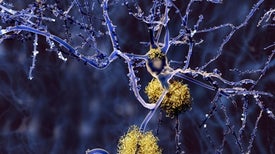 Landmark Alzheimer's Drug Approval Confounds Research Community