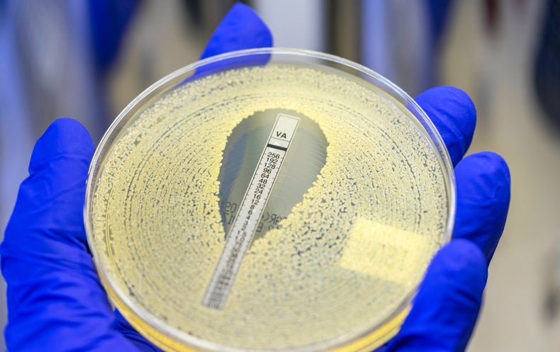 How do antibiotics kill bacterial cells but not human cells?