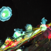 HONORABLE MENTION: HUMAN ASTROCYTOMA CELLS