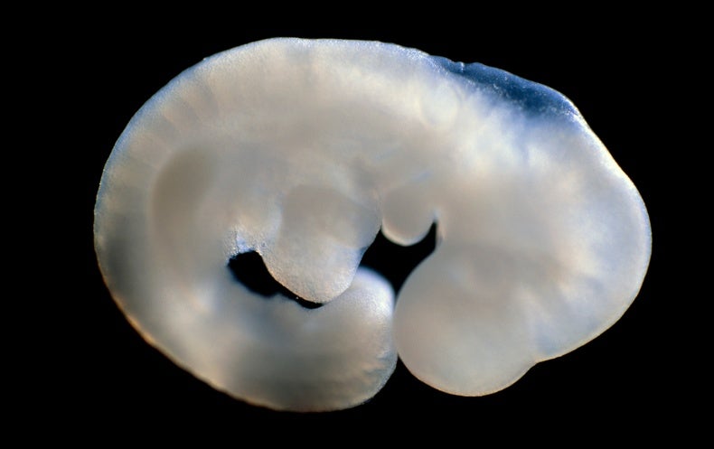 Japan Approves First Human-Animal Embryo Experiments - Scientific American