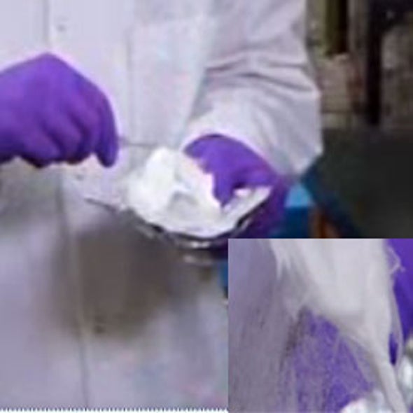 Vapor Trail: Electronic Noses Sniff Bad Breath for Signs of Disease