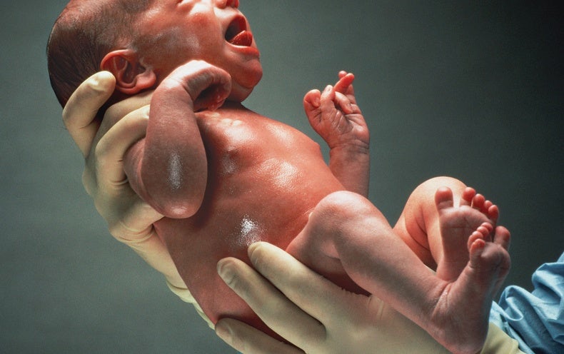 Full Genome Sequencing for Newborns Raises Questions - Scientific American