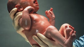Full Genome Sequencing for Newborns Raises Questions