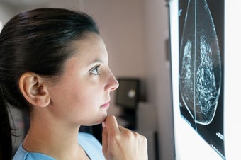 Google AI Tool Can Pinpoint Breast Cancer Better Than Clinicians