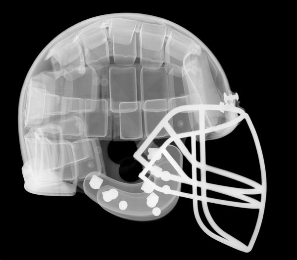 An x-ray of a football helmet