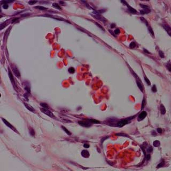 Researchers Design Patches of Cells to Repair Damaged Hearts