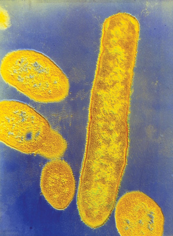 Gut Bacteria May Play a Role in Autism