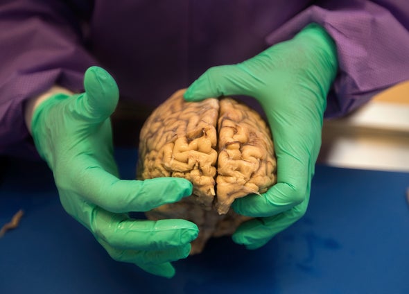 Striking Evidence Linking Football to Brain Disease Sparks Calls for More  Research - Scientific American