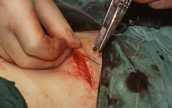 Hair Cells Could Heal Skin Sans Scars