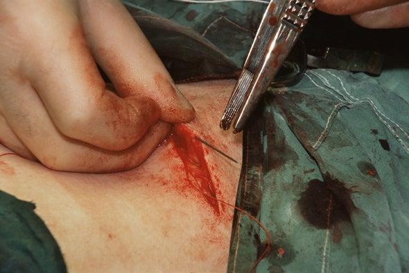 Hair Cells Could Heal Skin Sans Scars