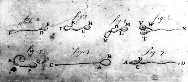 A faded drawing of human sperm in states of motion created by Dutch scientist Antonie van Leeuwenhoek.
