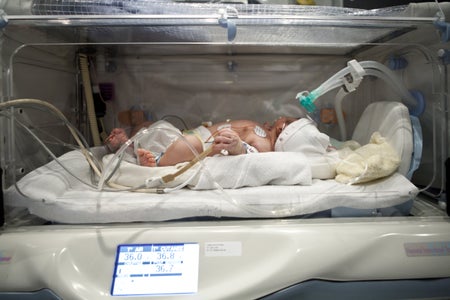 Hospitalized newborn with breathing difficulties in neonatal ICU