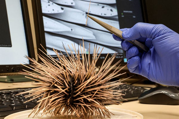 A gloved hand pulls a spine out of a sea urchin