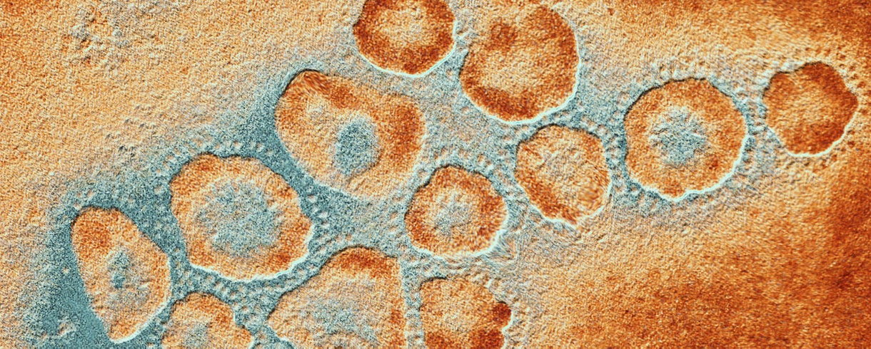The New Coronavirus Outbreak: What We Know So Far