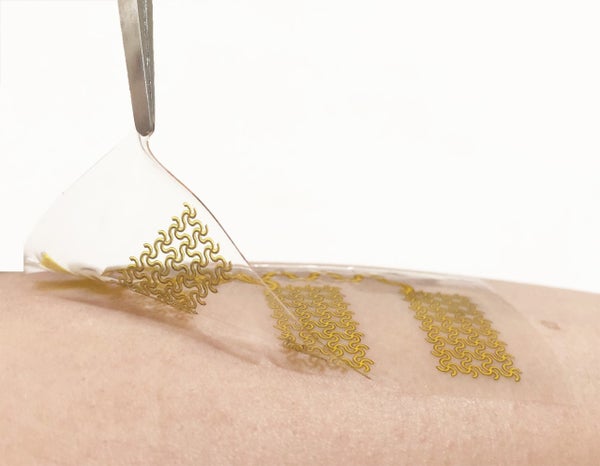Highly Stretchy Black Gold E‐Skin Nanopatches as Highly Sensitive Wearable  Biomedical Sensors - Gong - 2015 - Advanced Electronic Materials - Wiley  Online Library