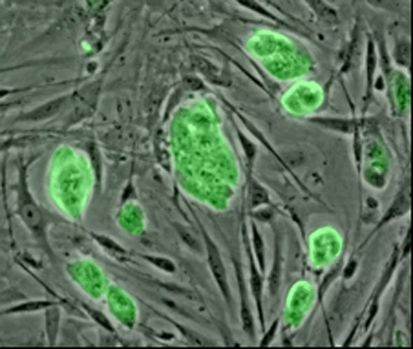 Stem Cell Company in Crisis