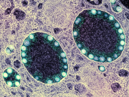 A micrograph of the virus that causes COVID.