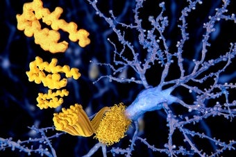 Could Medical Procedures Transmit Alzheimer's?