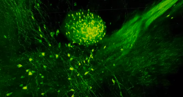 Scientists Create a Window into the Brain [Video]