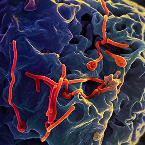 Why Some Ebola Strains Are More Dangerous Than Others - Scientific American