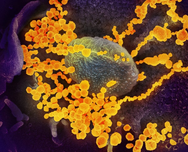 A model that uses artificial intelligence could help predict new variants of SARS-CoV-2, the virus that causes COVID (shown in gold).