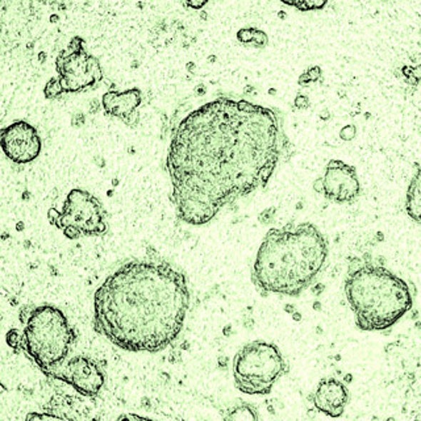 Body May Reject Transplanted Human Embryonic Stem Cells