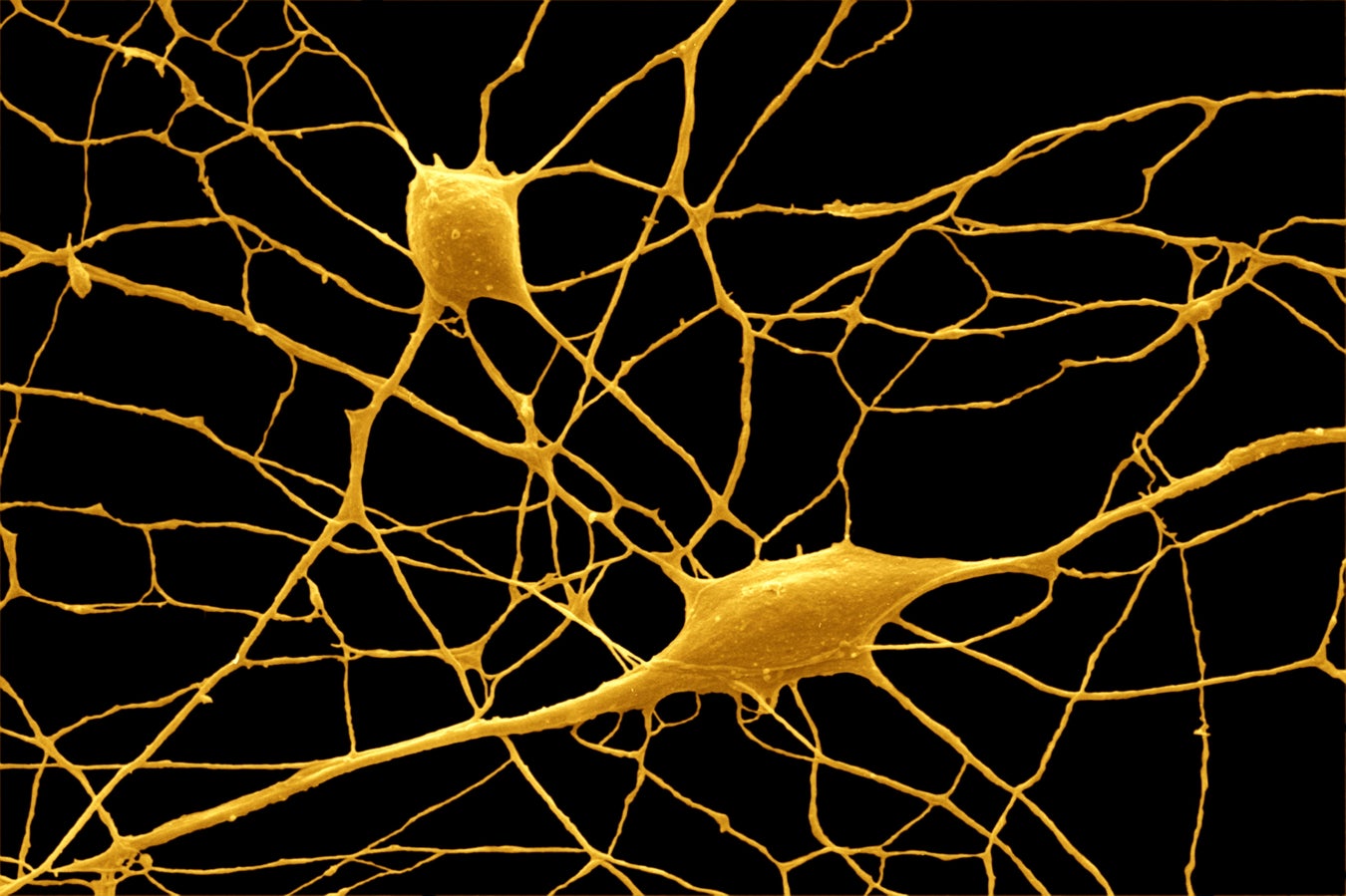 Is "Junk DNA" What Makes Humans Unique? Scientific American