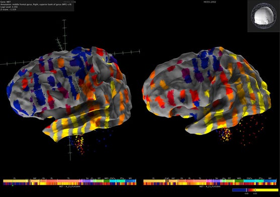 New Views of the Brain [Slide Show]