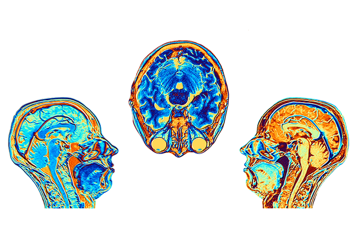 AI Re-Creates Activity Patterns That Brain Cells Use in Navigation ...