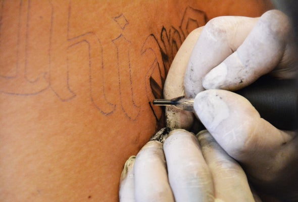 Tats Off: Targeting the Immune System May Lead to Better Tattoo Removal