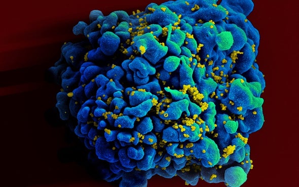 转基因T细胞可能有助于抗击HIV