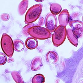 parasitic worms autoimmune helminthic