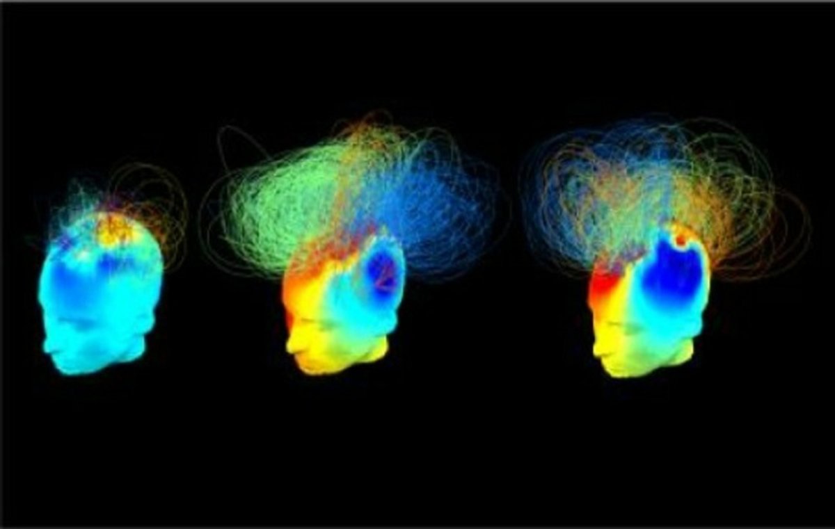 Searching for Signs of Consciousness | Scientific American