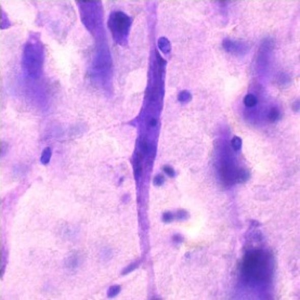 Neurons Offer Clues to Suicide