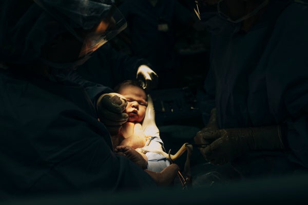 A baby is seen in doctors' hands during a c-section.